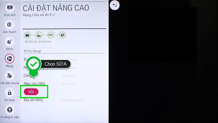 Hướng dẫn cài đặt IP và DNS mạng cho Smart tivi LG hệ điều hành WebOS